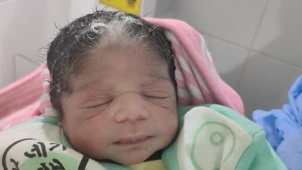 واقعة غريبة بمصر.. ولادة طفلة بشعر أبيض في الأقصر